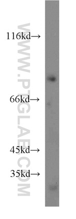 FGD3 Antibody in Western Blot (WB)