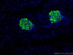 Secretogranin II Antibody in Immunohistochemistry (Paraffin) (IHC (P))