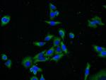 PRKAR1A Antibody in Immunocytochemistry (ICC/IF)