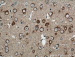 PRKAR1A Antibody in Immunohistochemistry (Paraffin) (IHC (P))