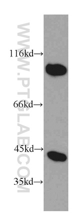 PRKAR1A Antibody in Western Blot (WB)