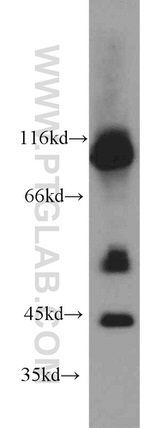 PRKAR1A Antibody in Western Blot (WB)