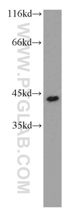 PRKAR1A Antibody in Western Blot (WB)