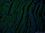 MYOM1 Antibody in Immunohistochemistry (PFA fixed) (IHC (PFA))