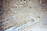 MYOM1 Antibody in Immunohistochemistry (Paraffin) (IHC (P))