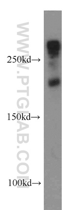 MYOM1 Antibody in Western Blot (WB)