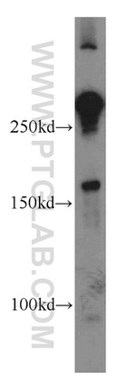 MYOM1 Antibody in Western Blot (WB)