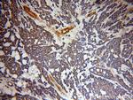 UBN1 Antibody in Immunohistochemistry (Paraffin) (IHC (P))