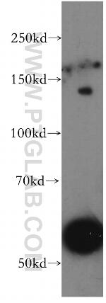 UBN1 Antibody in Western Blot (WB)