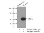 RbAp46 Antibody in Immunoprecipitation (IP)