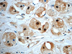 SUZ12 Antibody in Immunohistochemistry (Paraffin) (IHC (P))