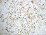 SUZ12 Antibody in Immunohistochemistry (Paraffin) (IHC (P))