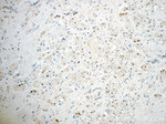 SUZ12 Antibody in Immunohistochemistry (Paraffin) (IHC (P))