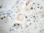 SUZ12 Antibody in Immunohistochemistry (Paraffin) (IHC (P))