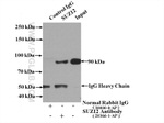 SUZ12 Antibody in Immunoprecipitation (IP)