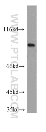 SUZ12 Antibody in Western Blot (WB)