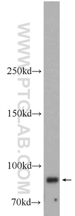 SUZ12 Antibody in Western Blot (WB)