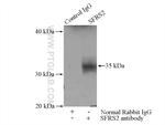 SFRS2 Antibody in Immunoprecipitation (IP)