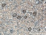 NPHS2 Antibody in Immunohistochemistry (Paraffin) (IHC (P))