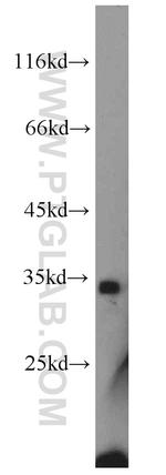 NPHS2 Antibody in Western Blot (WB)