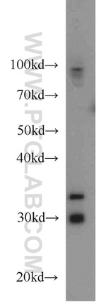 PLEKHF1 Antibody in Western Blot (WB)