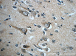 GLUT3 Antibody in Immunohistochemistry (Paraffin) (IHC (P))