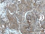 GLUT3 Antibody in Immunohistochemistry (Paraffin) (IHC (P))