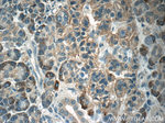 SSTR2 Antibody in Immunohistochemistry (Paraffin) (IHC (P))