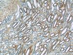 SSTR2 Antibody in Immunohistochemistry (Paraffin) (IHC (P))