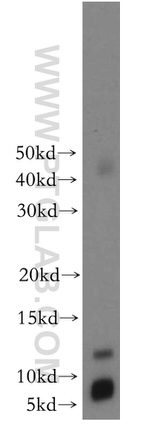 SNRPE Antibody in Western Blot (WB)