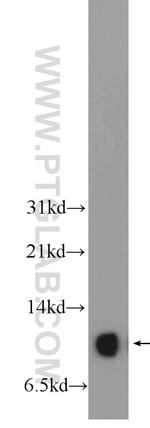 SNRPE Antibody in Western Blot (WB)