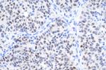 FOXA1 Antibody in Immunohistochemistry (Paraffin) (IHC (P))