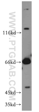 FOXA1 Antibody in Western Blot (WB)