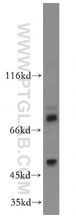 FOXA1 Antibody in Western Blot (WB)