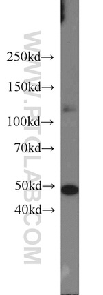 FOXA1 Antibody in Western Blot (WB)