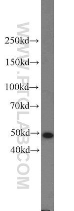 FOXA1 Antibody in Western Blot (WB)