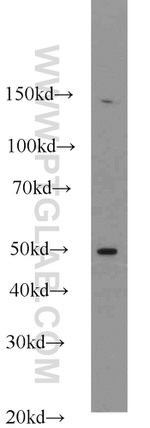 FOXA1 Antibody in Western Blot (WB)