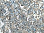 C11orf67 Antibody in Immunohistochemistry (Paraffin) (IHC (P))