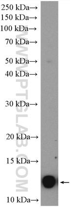 C11orf67 Antibody in Western Blot (WB)