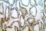 C11orf67 Antibody in Immunohistochemistry (Paraffin) (IHC (P))