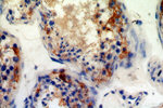 C11orf67 Antibody in Immunohistochemistry (Paraffin) (IHC (P))