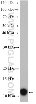 C11orf67 Antibody in Western Blot (WB)