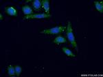 PIGM Antibody in Immunocytochemistry (ICC/IF)