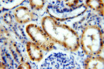 PIGM Antibody in Immunohistochemistry (Paraffin) (IHC (P))