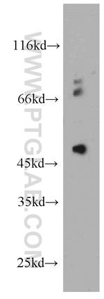 PIGM Antibody in Western Blot (WB)