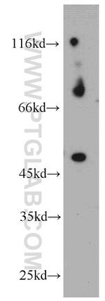 PIGM Antibody in Western Blot (WB)