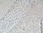 CXCR7 Antibody in Immunohistochemistry (Paraffin) (IHC (P))