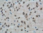 CXCR7 Antibody in Immunohistochemistry (Paraffin) (IHC (P))