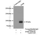 INSR Antibody in Immunoprecipitation (IP)