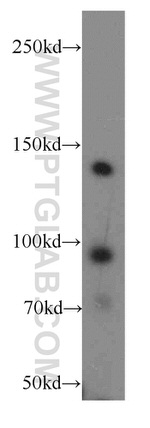 INSR Antibody in Western Blot (WB)